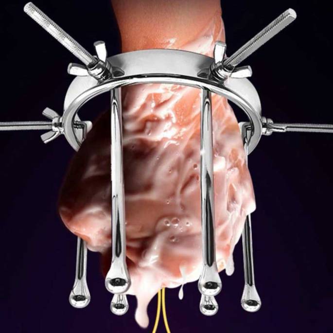 SPECULUM DILATATION FIST